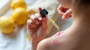 natural wart removal methods